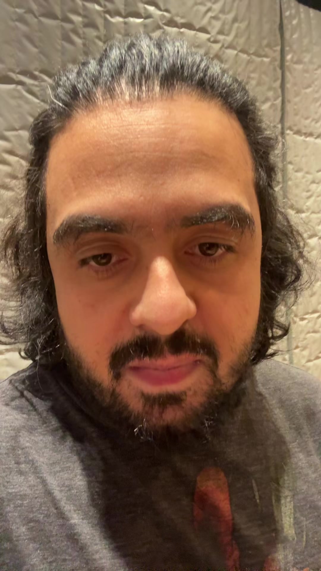 @Sanju