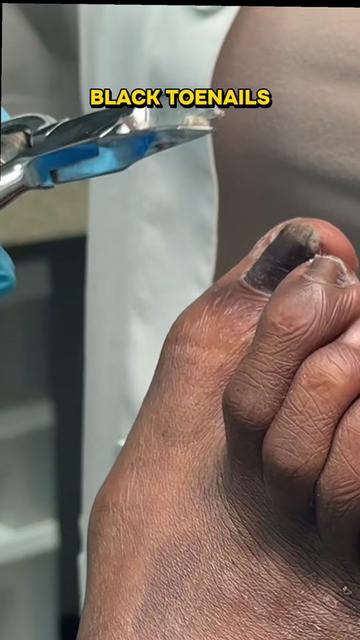 @Deniel Foot and Ankle Center
