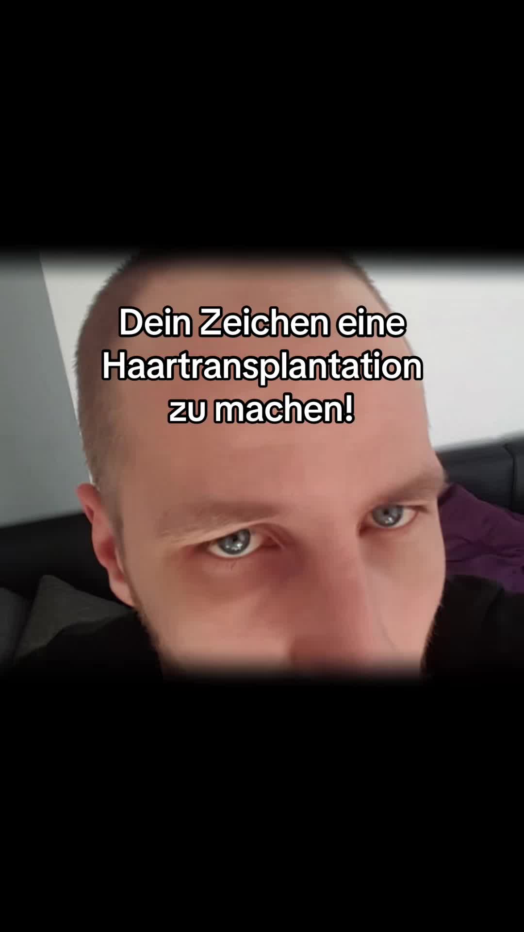 @Mr. Hairtransplant