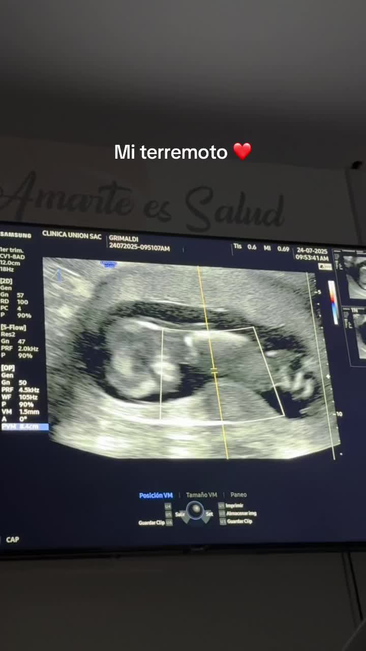 @Esc&aacute;pate conmigo | 📲💍