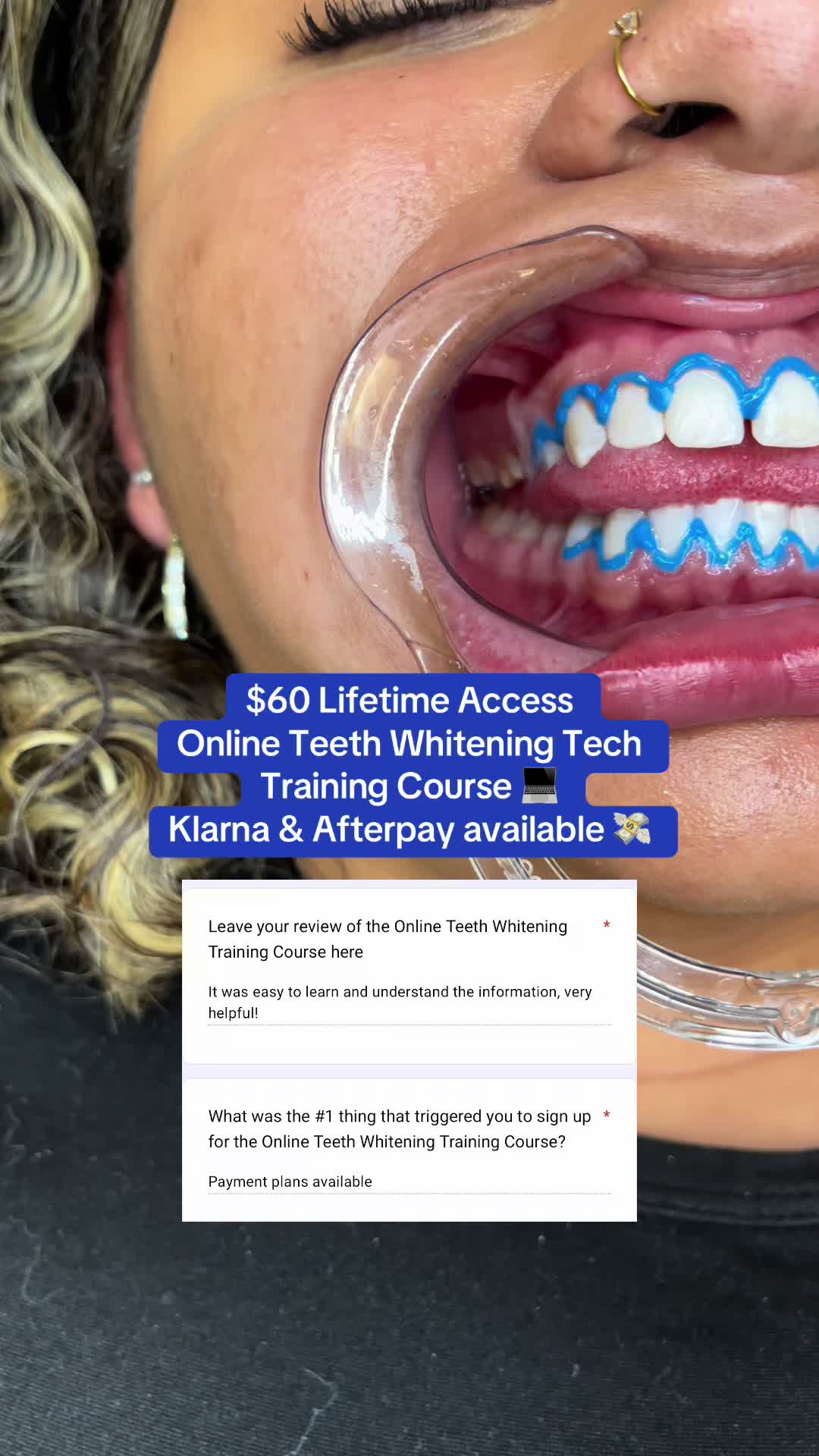 @Diandra | Teeth Whitening Tech