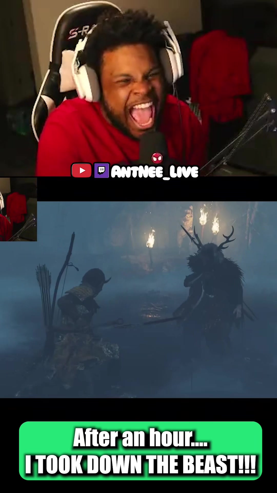 @AntNee Live