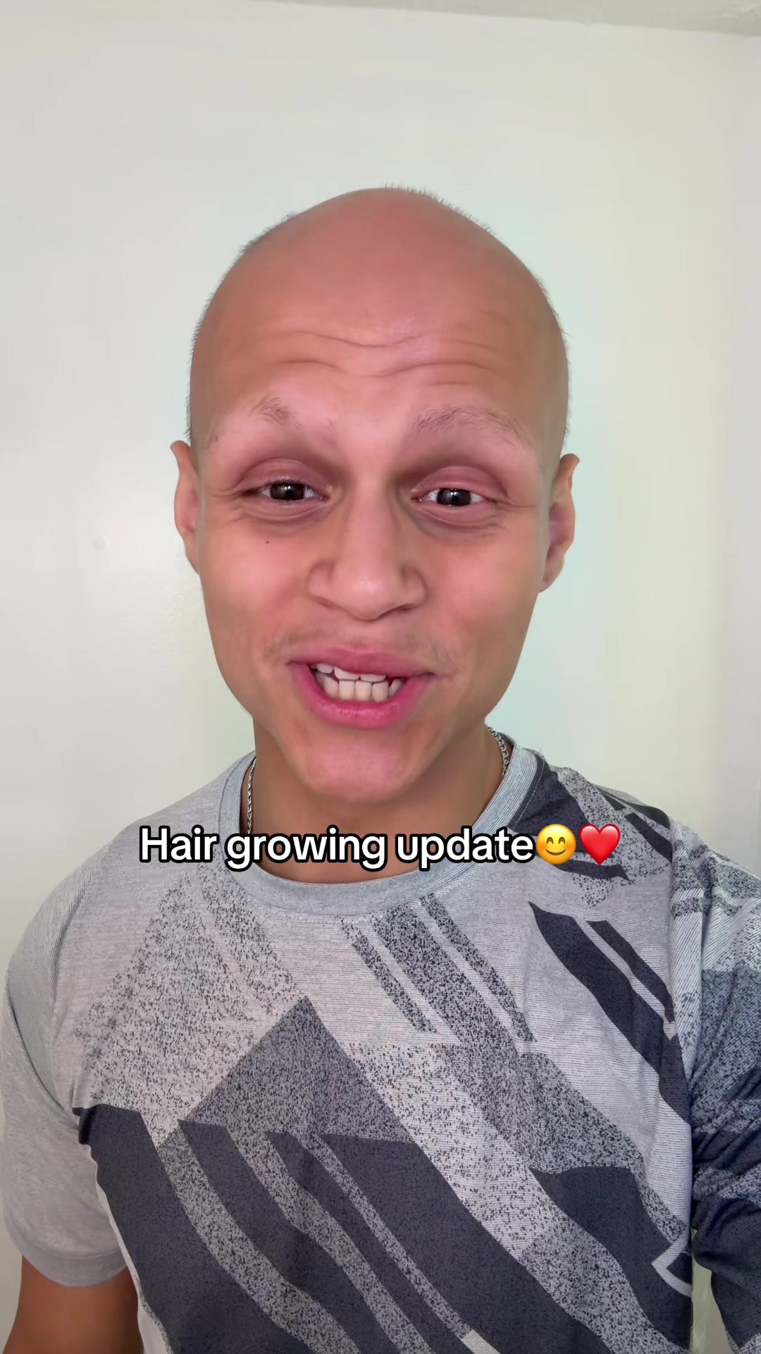 @GxbrielPn