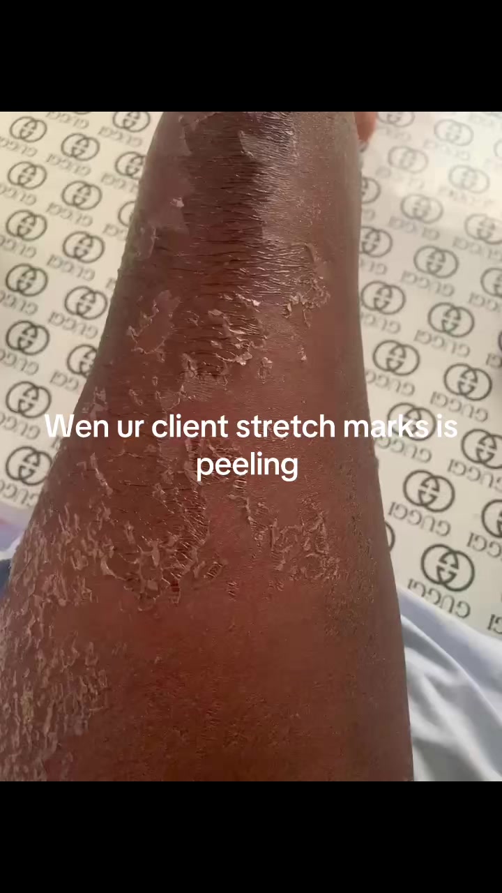 @@ Precious peeling soap