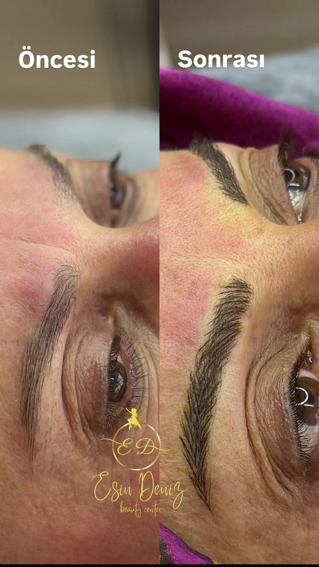@Esin Deniz Beauty center