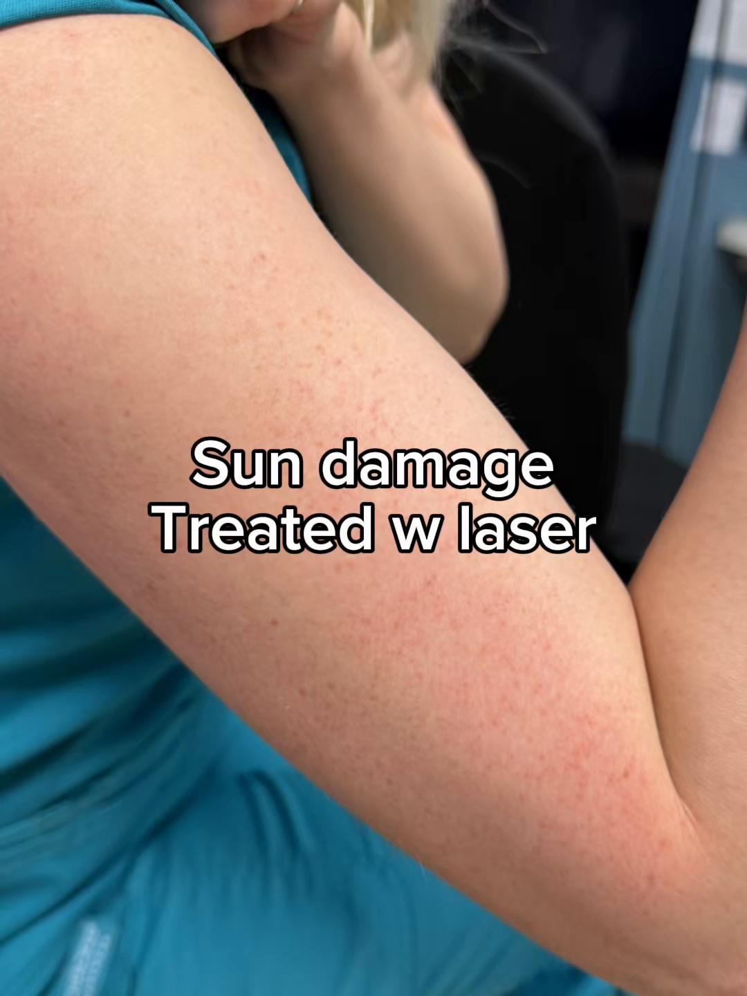 @Rosedermnyc
