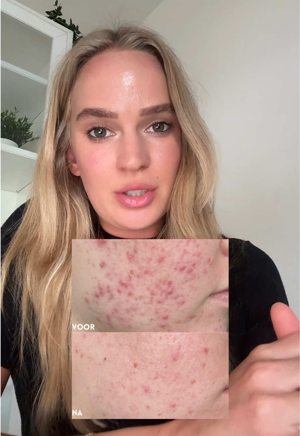 @Skinfixer