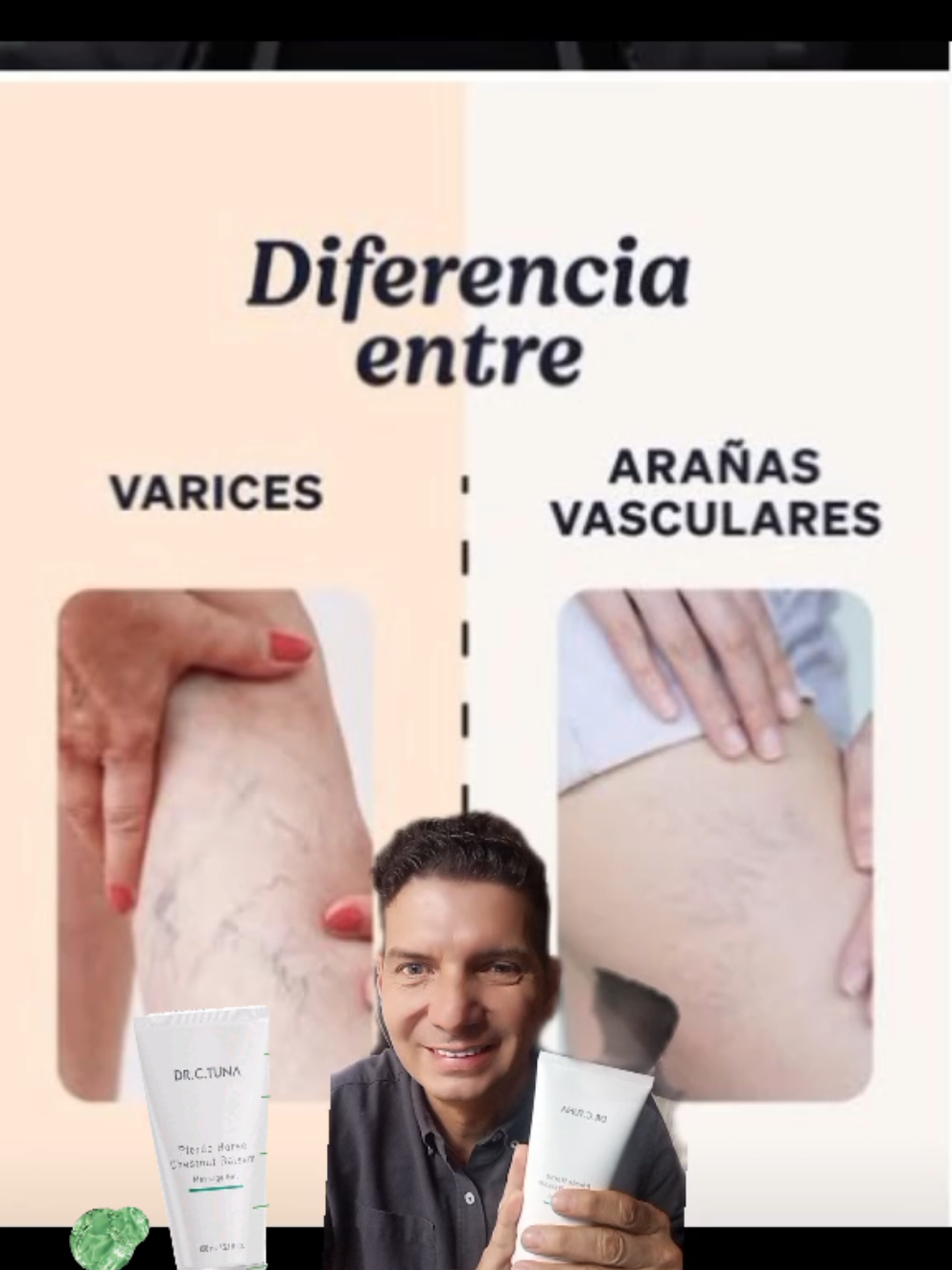 @Fabri Palacio