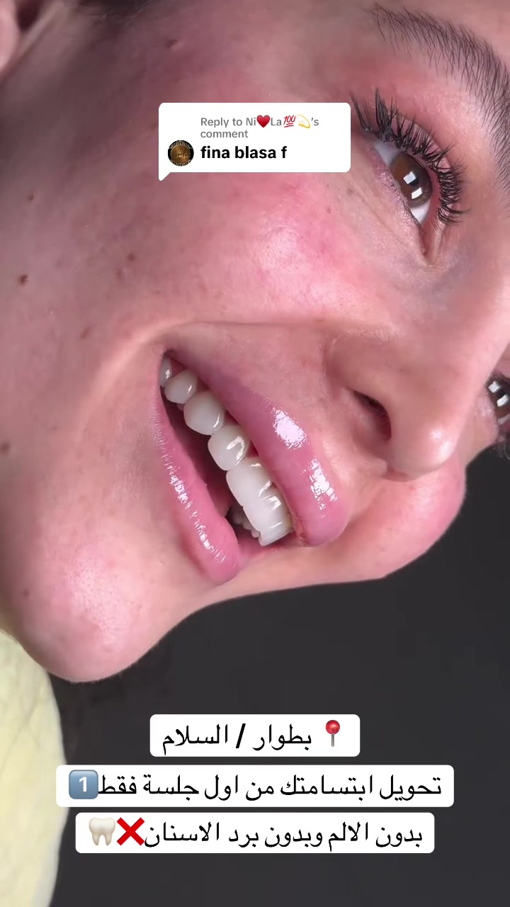 @brightsmileee1