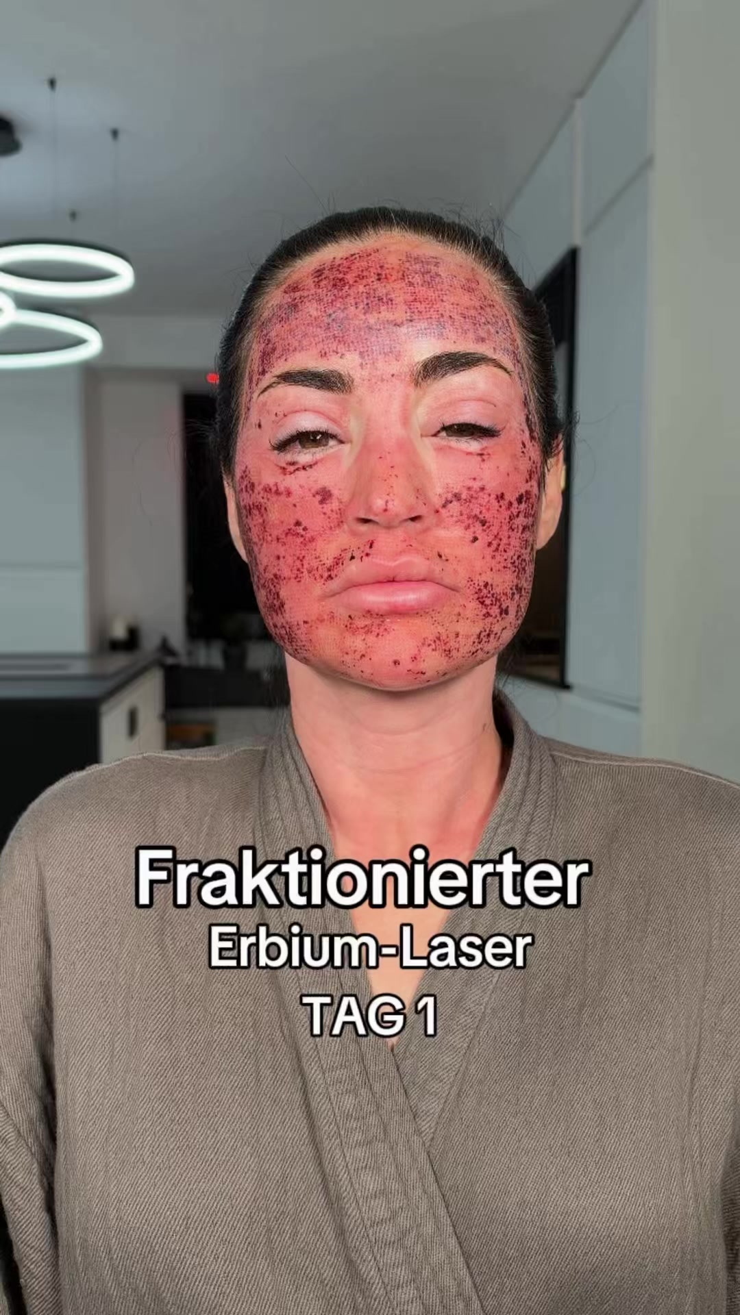 @Melissa | BEAUTYEXPERT