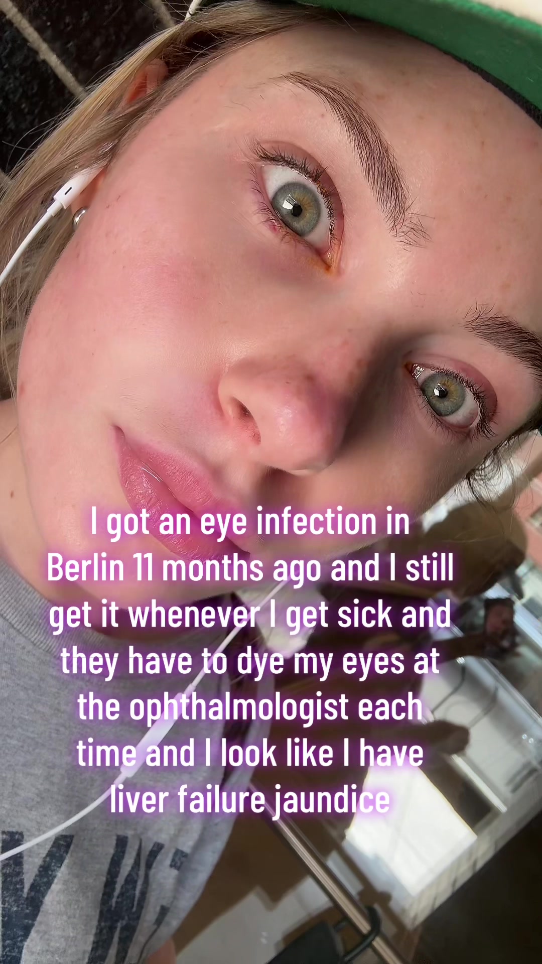 @DingleBerryDankeSch&ouml;n