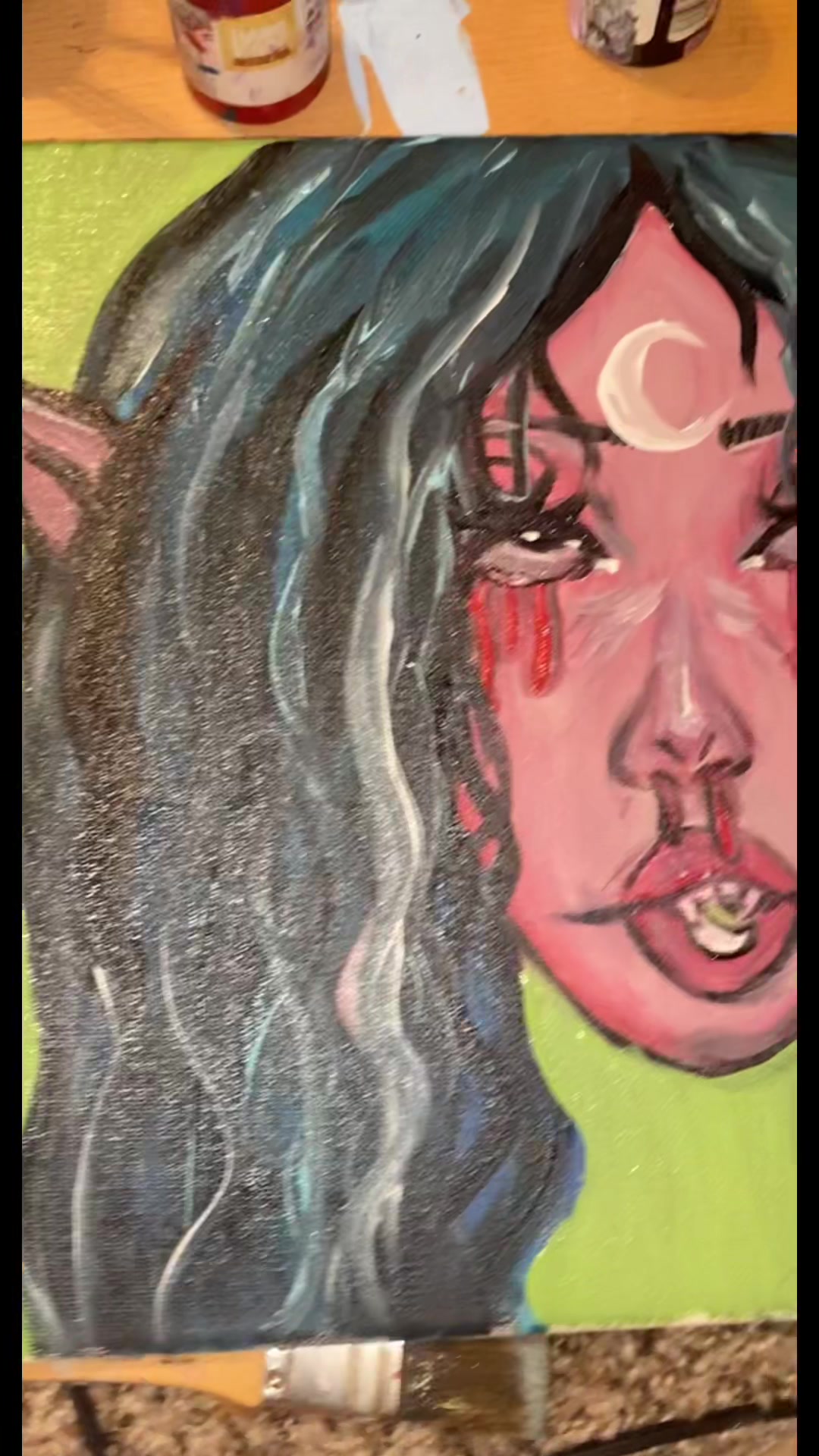 @mouthgag