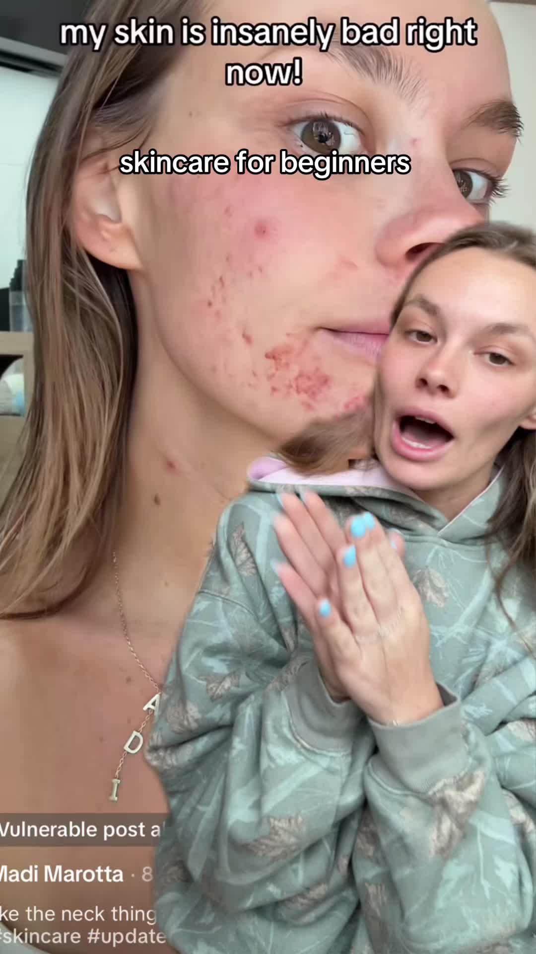 @Madi Marotta