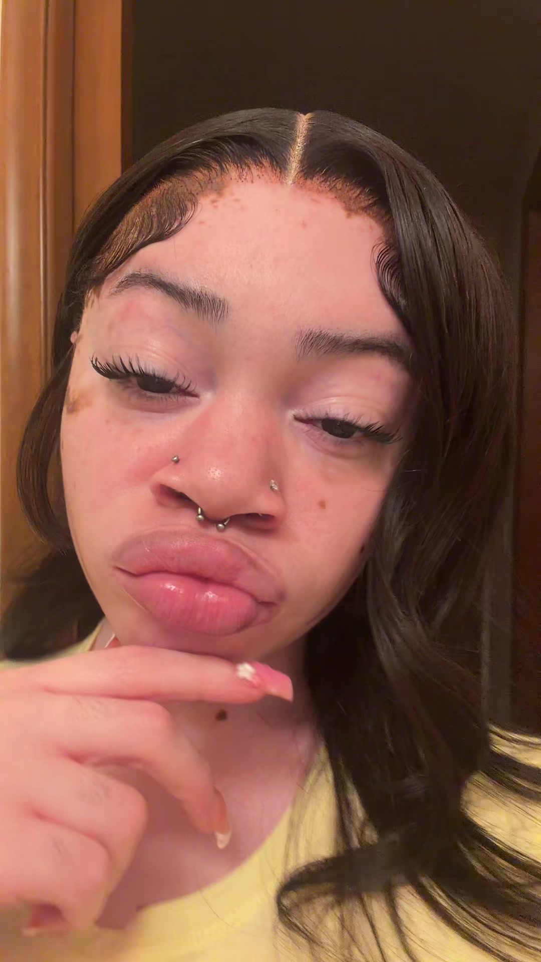 @rae