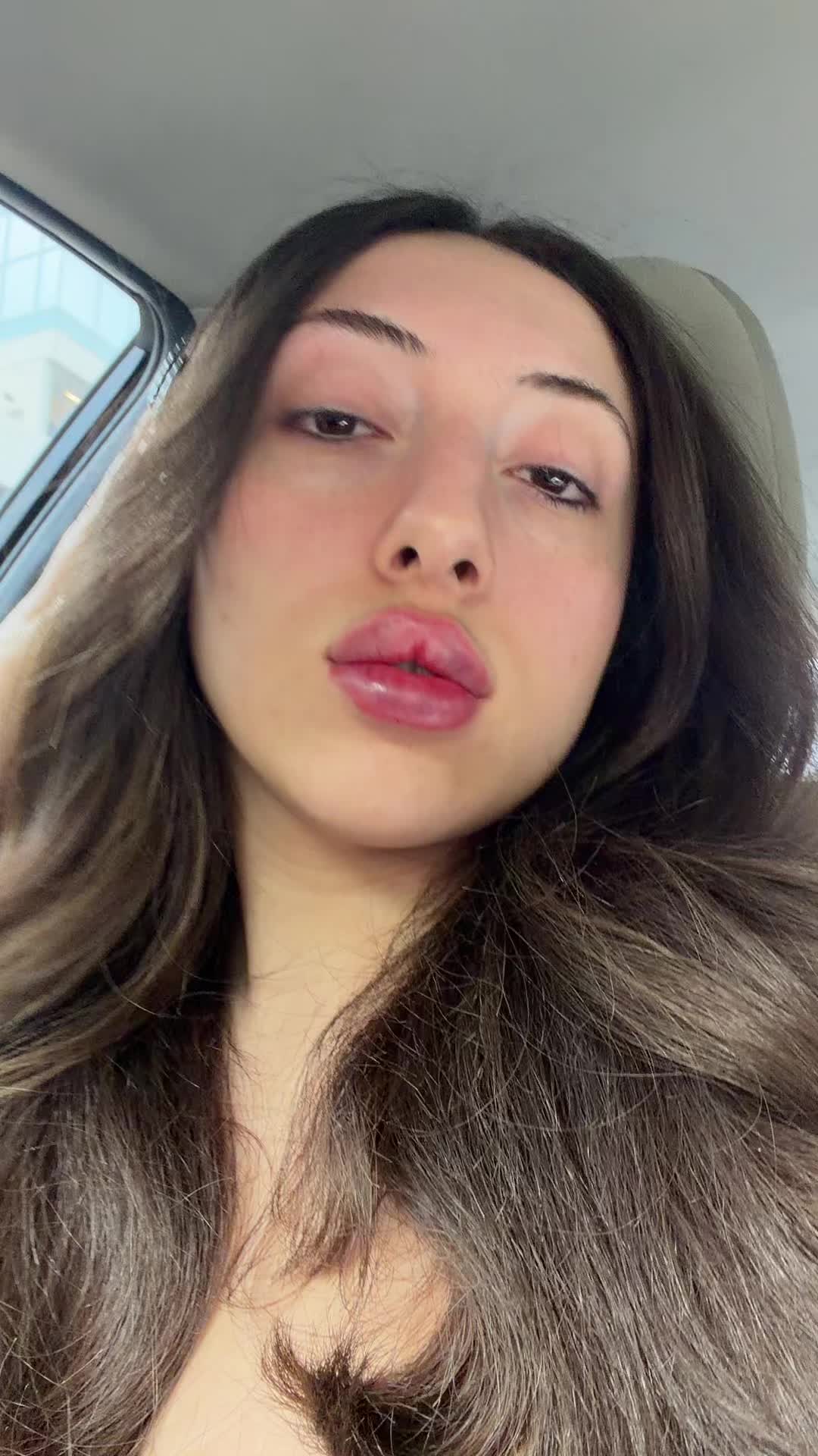 @🪩