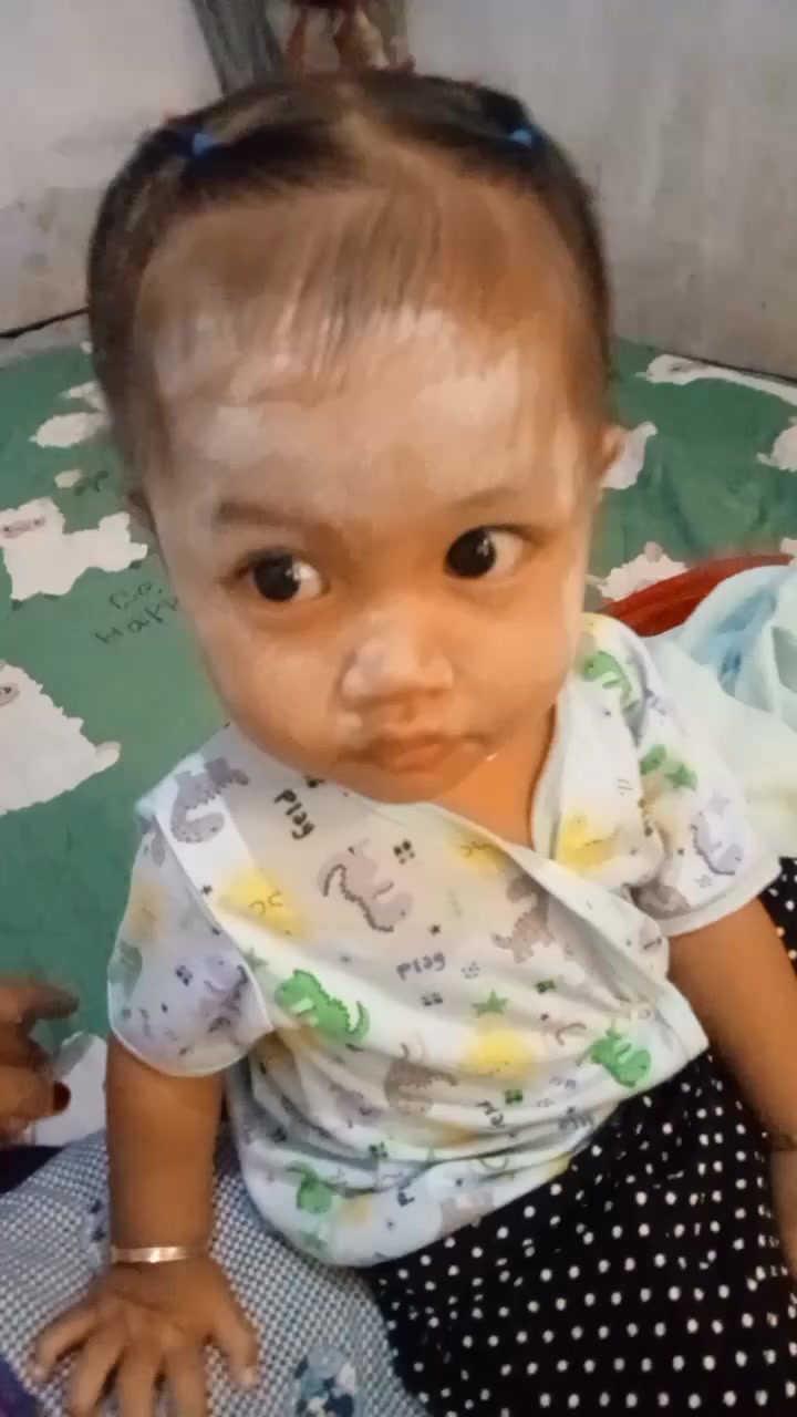 @Epa