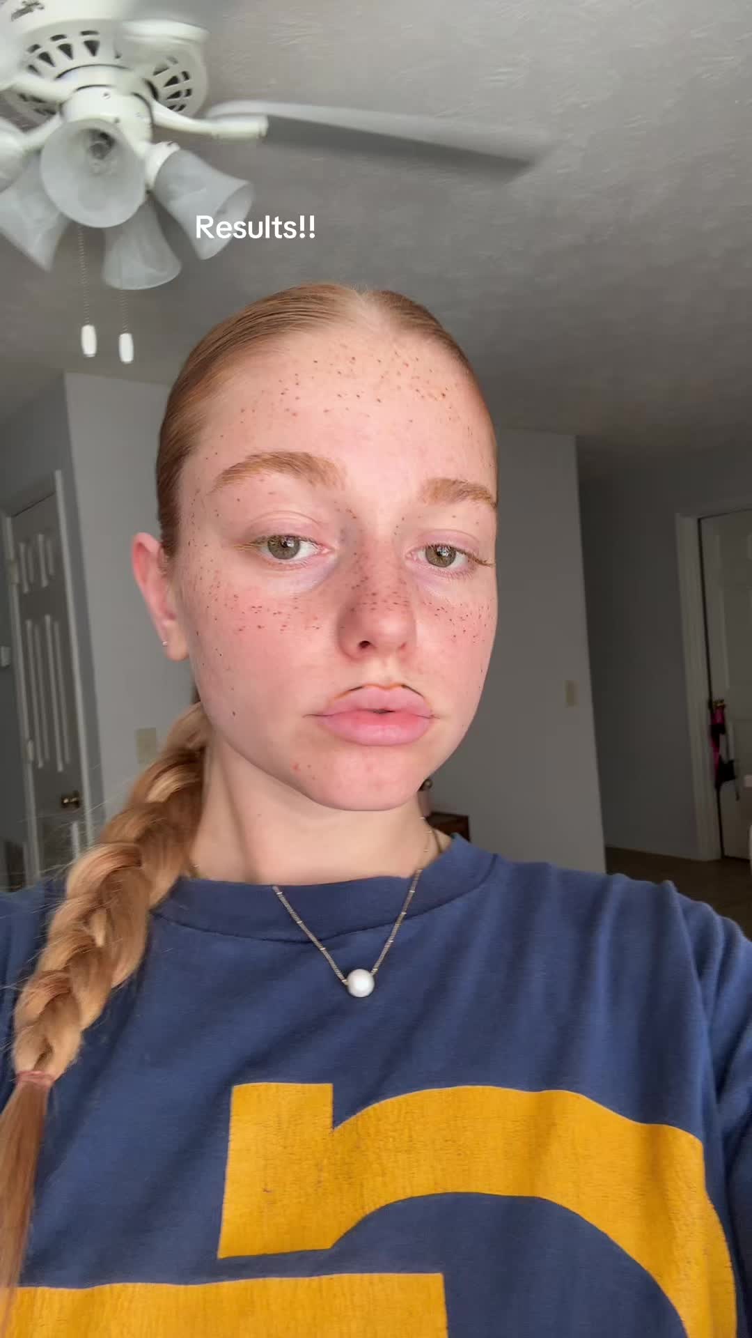 @Hopey