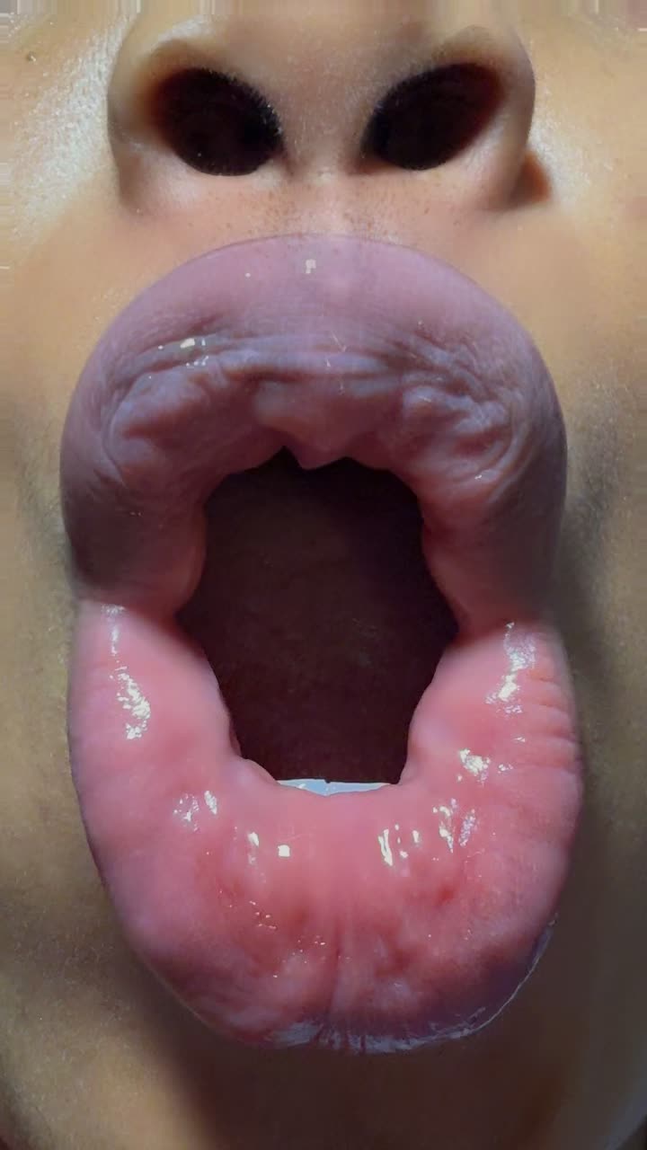 @Ebube