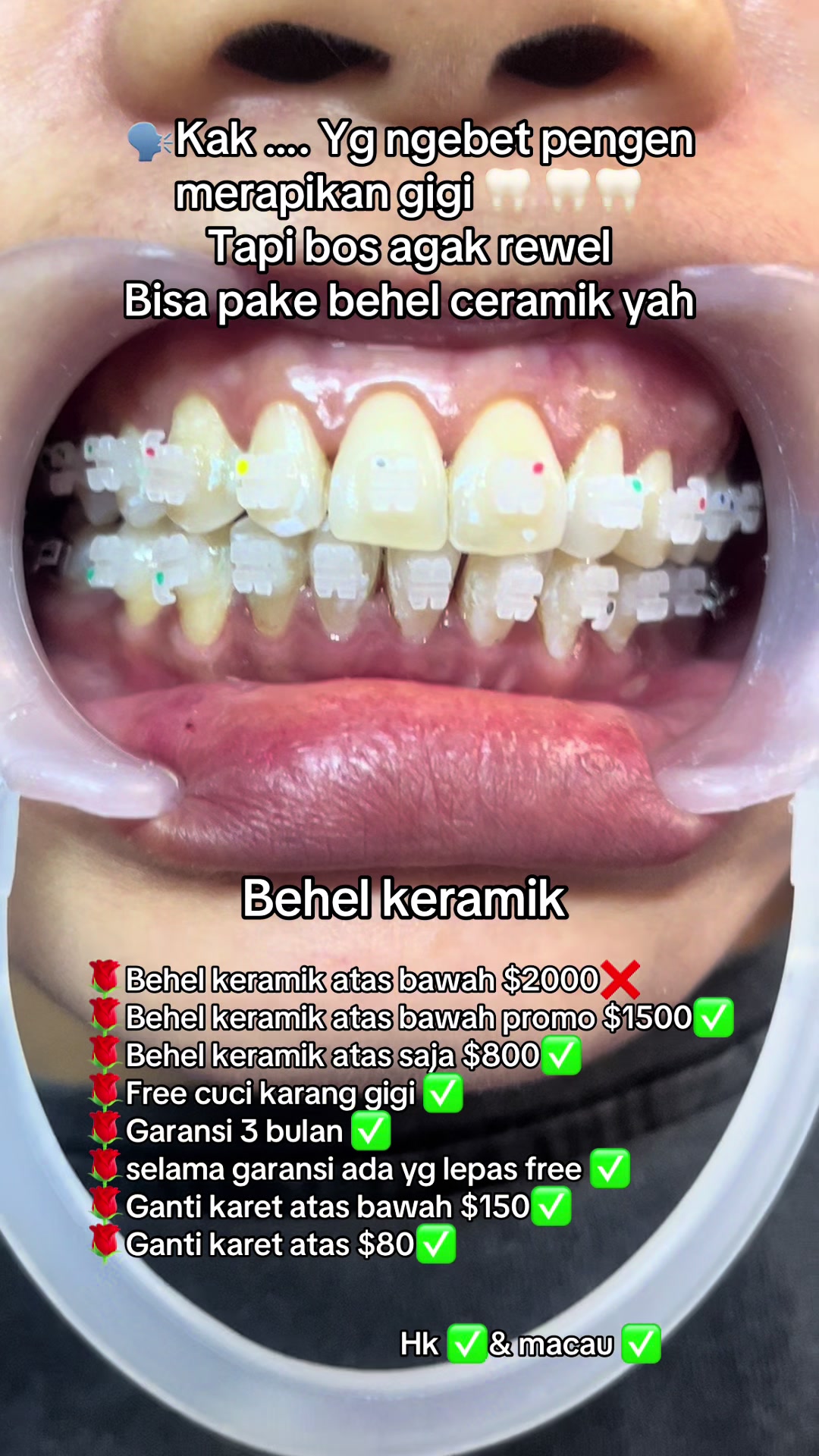 @mbak-Paijem