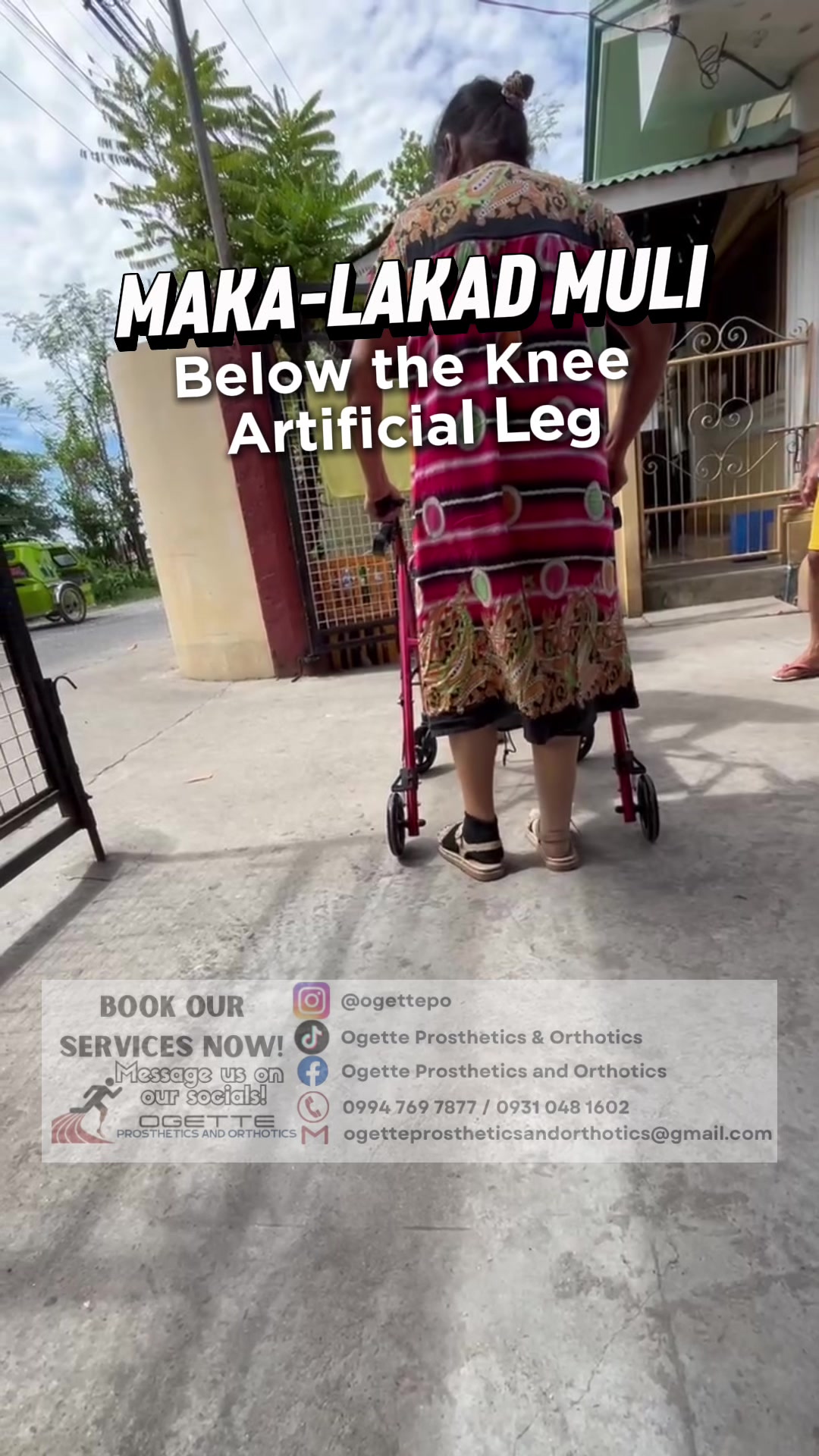 @Ogette Prosthetics & Orthotics
