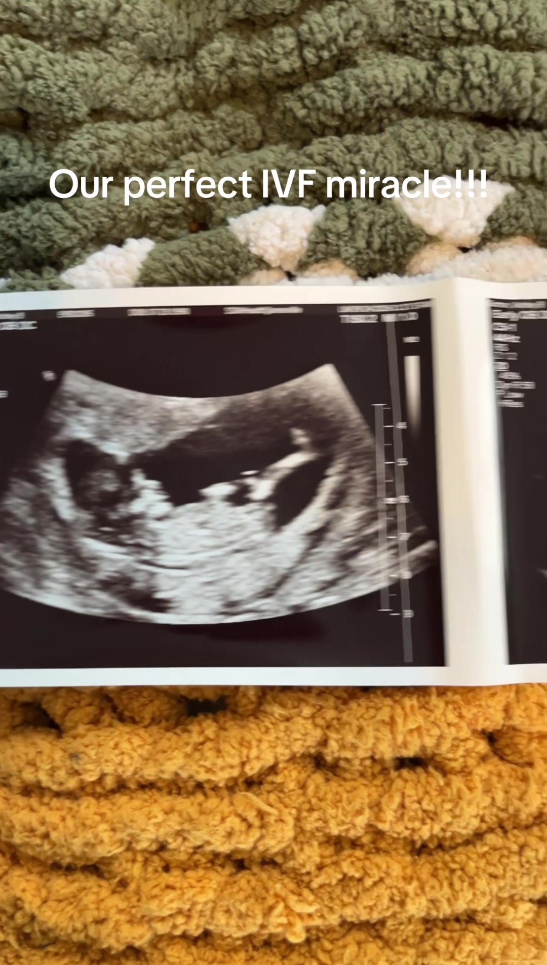 @Ashley Gorton | IVF Journey