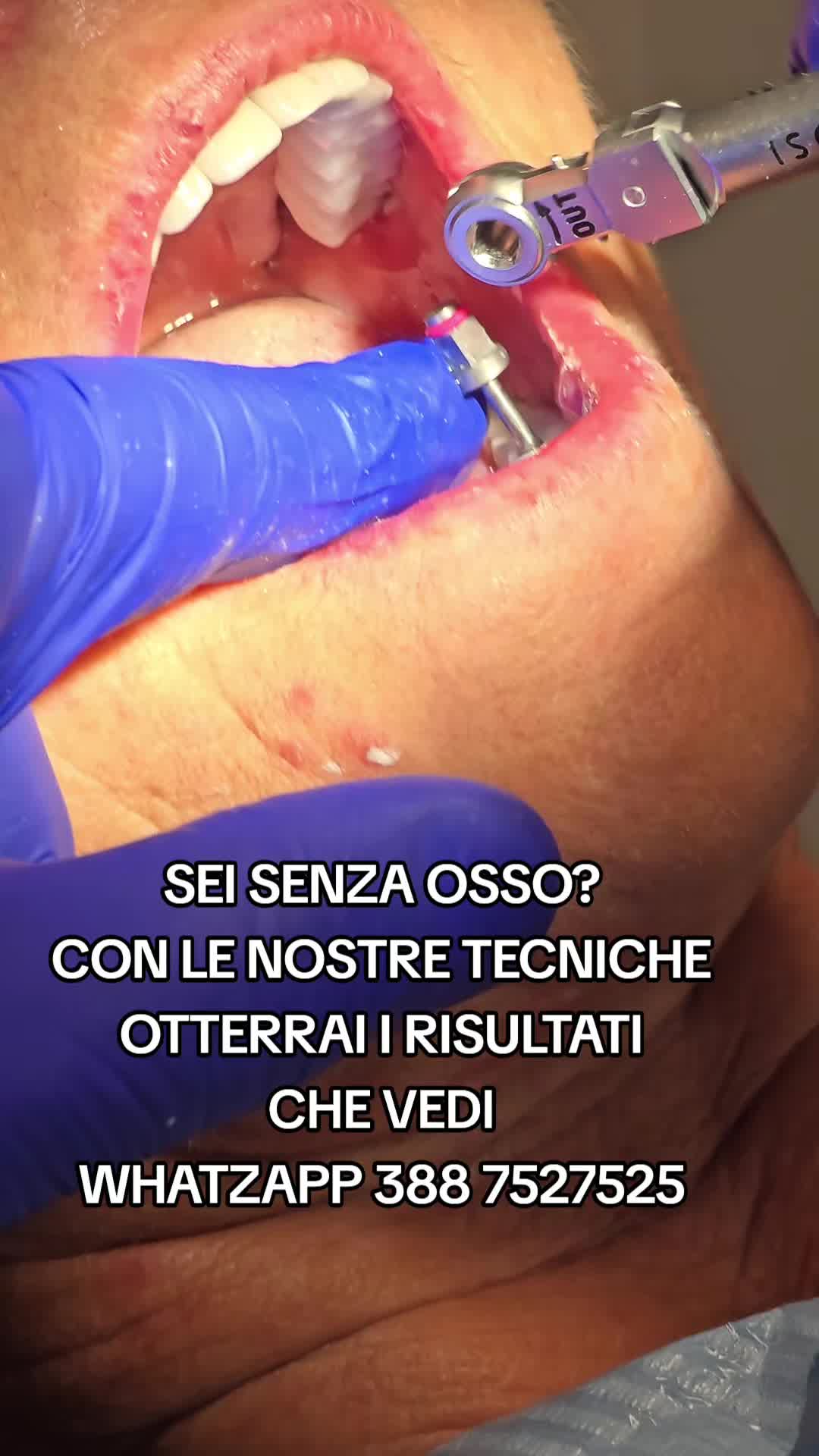 @Implantologiaprezzi