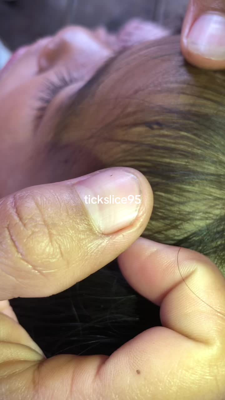 @Tickslice95
