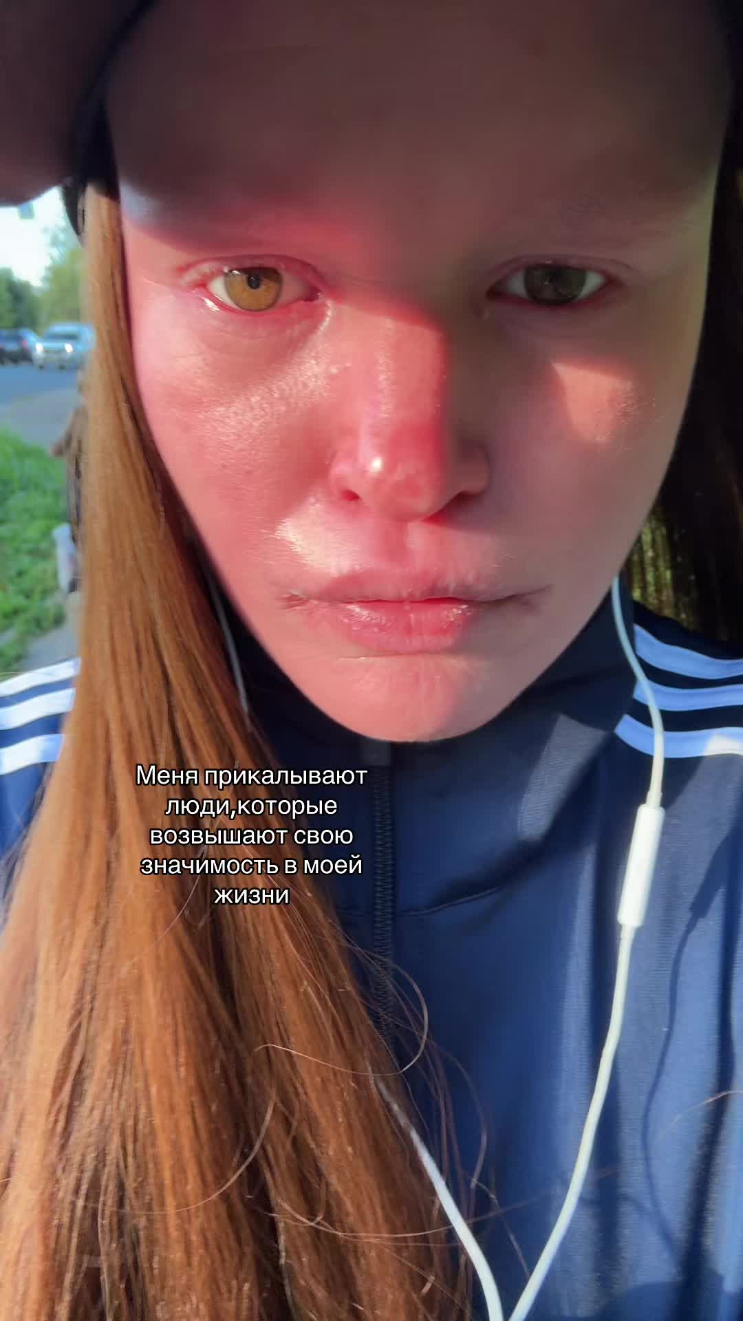 @Toxxzaaa