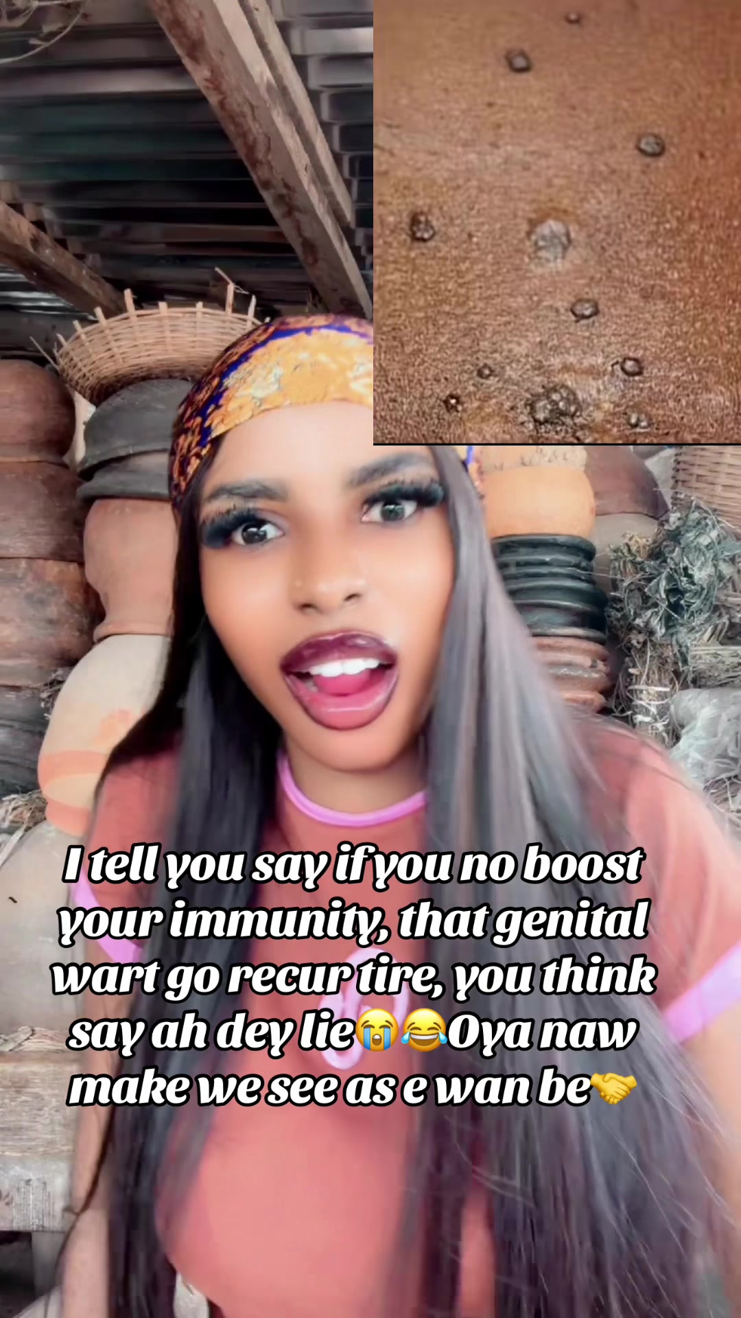 @GeNz_alagbo🪾🐍🍯