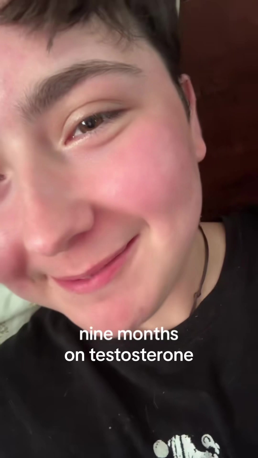 @Jonah 𐂂