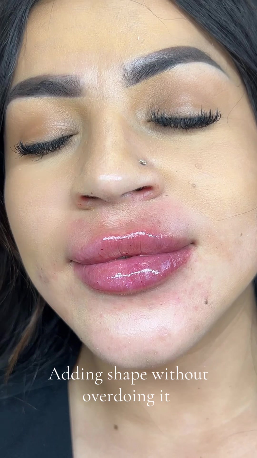 @injectormami