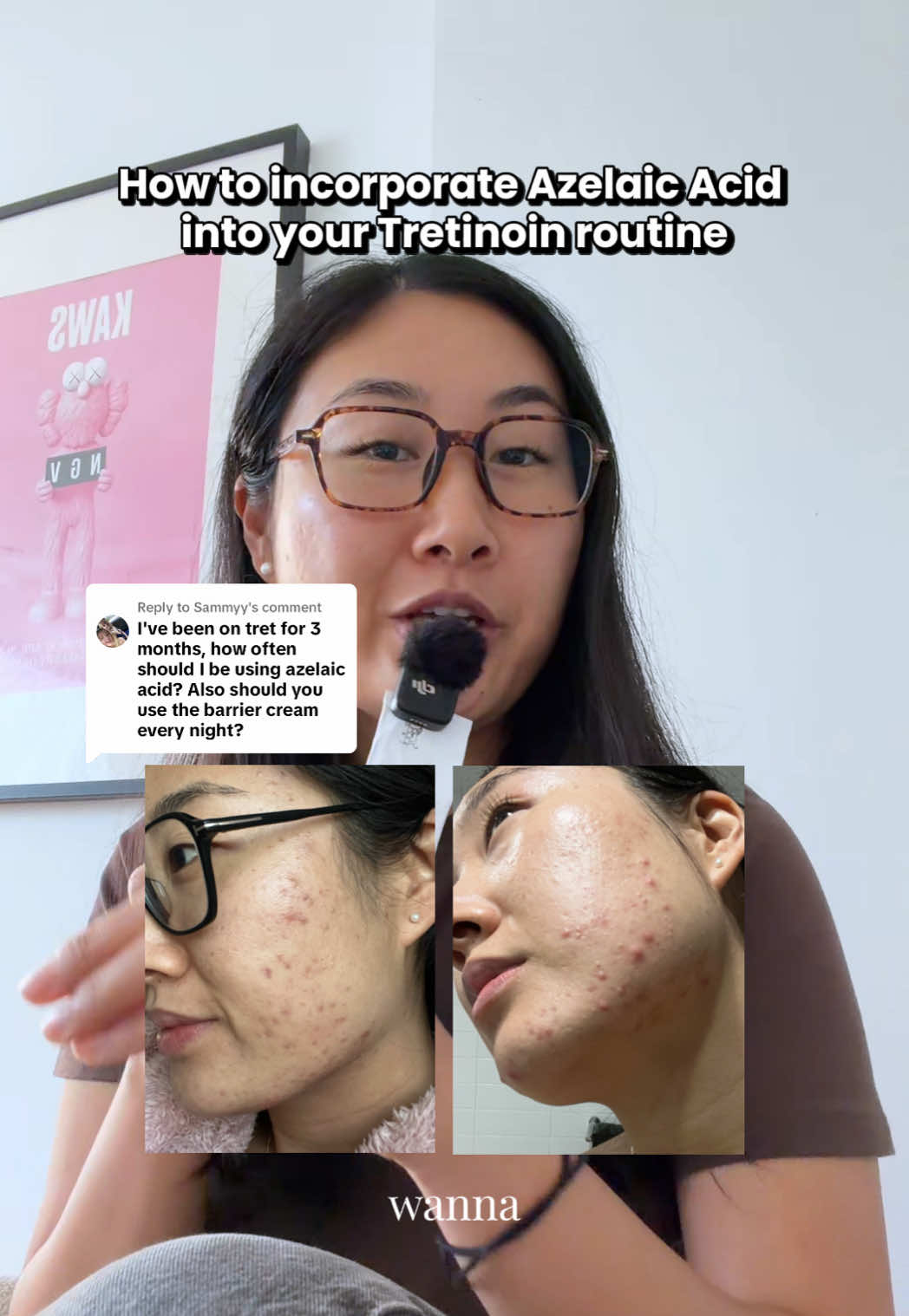 @Lisa | acne → clear skin