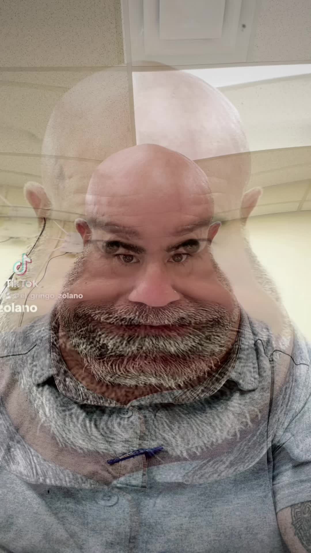 @eL GringoZolano™️❌⚒️