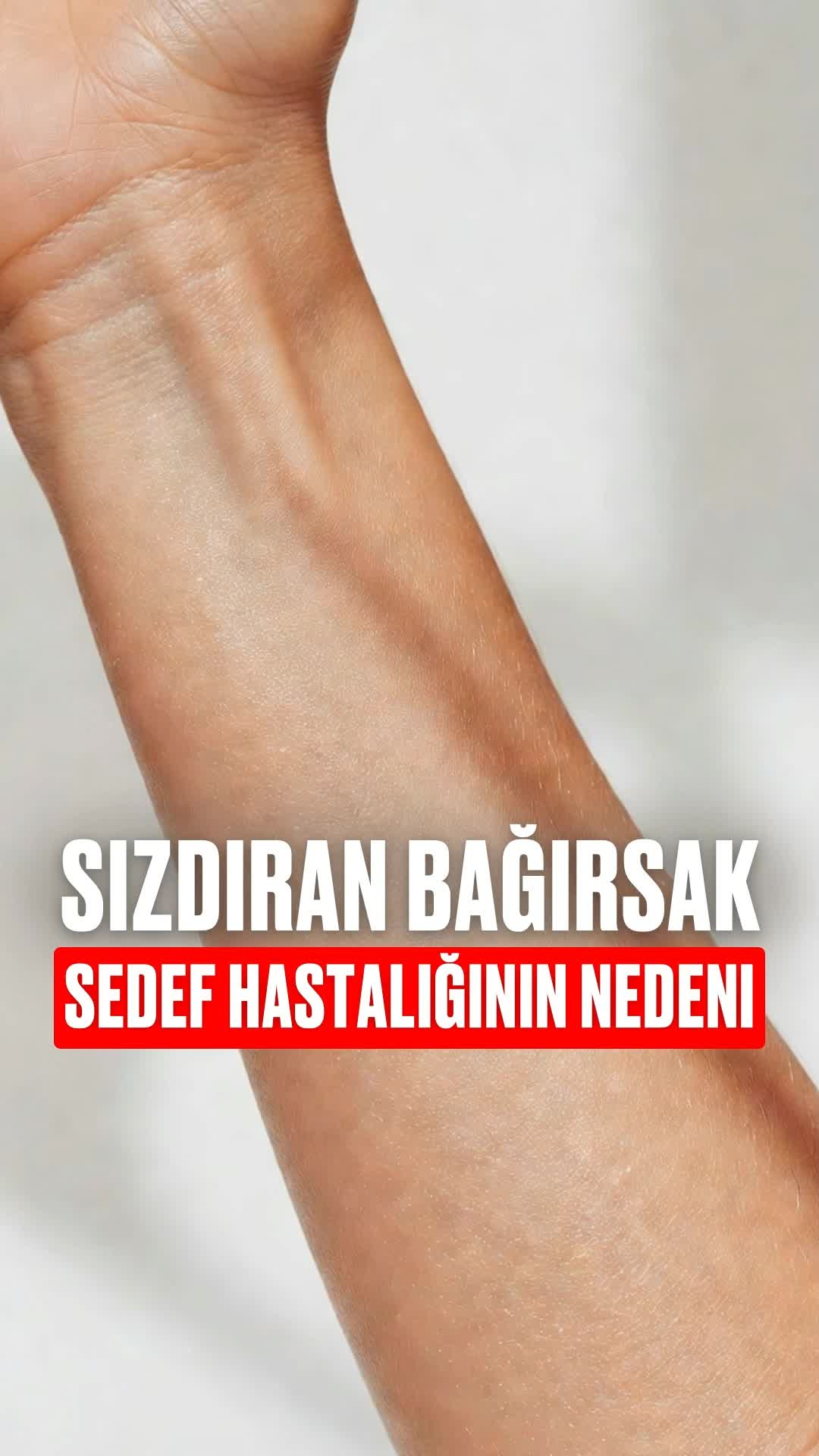 @bolotov_merkezi