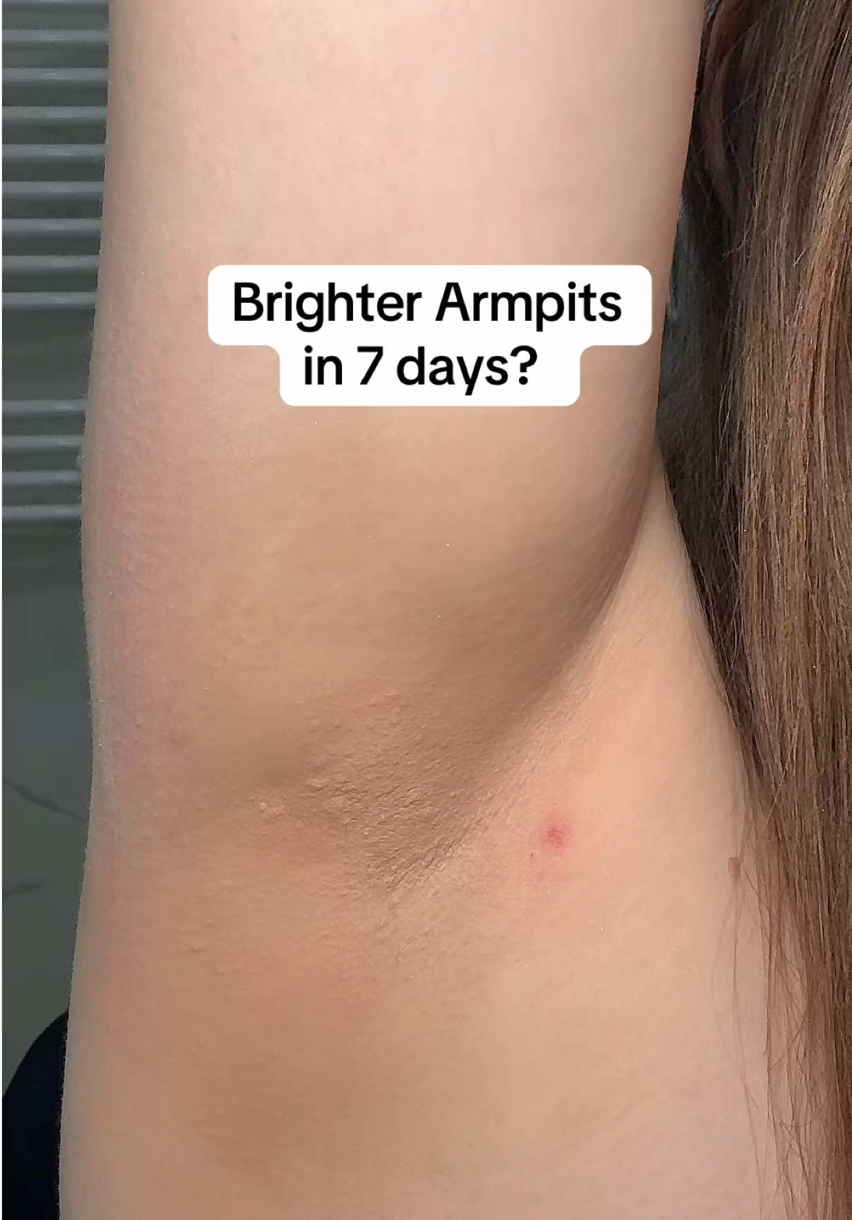 @watermelonsugarskin