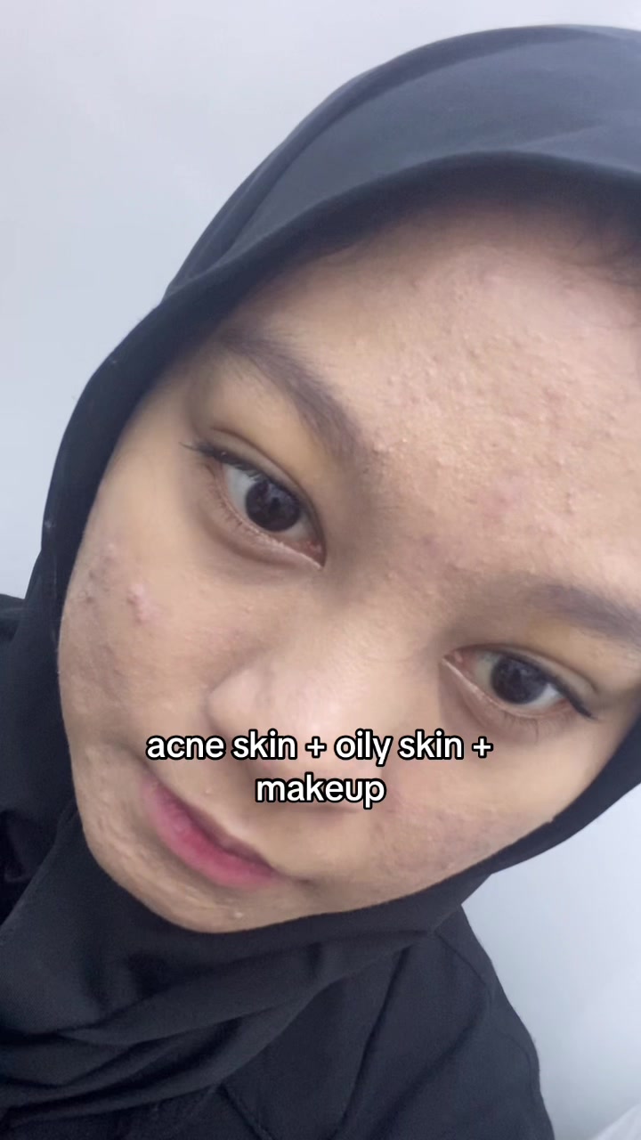 @chisin
