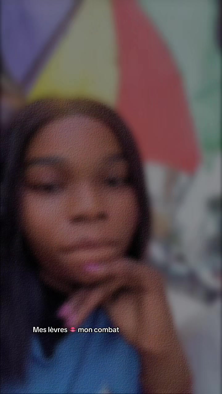 @Mungala deluxe