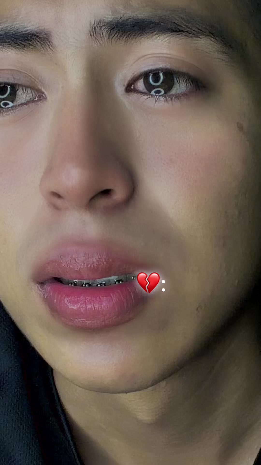 @Fernando🎗️