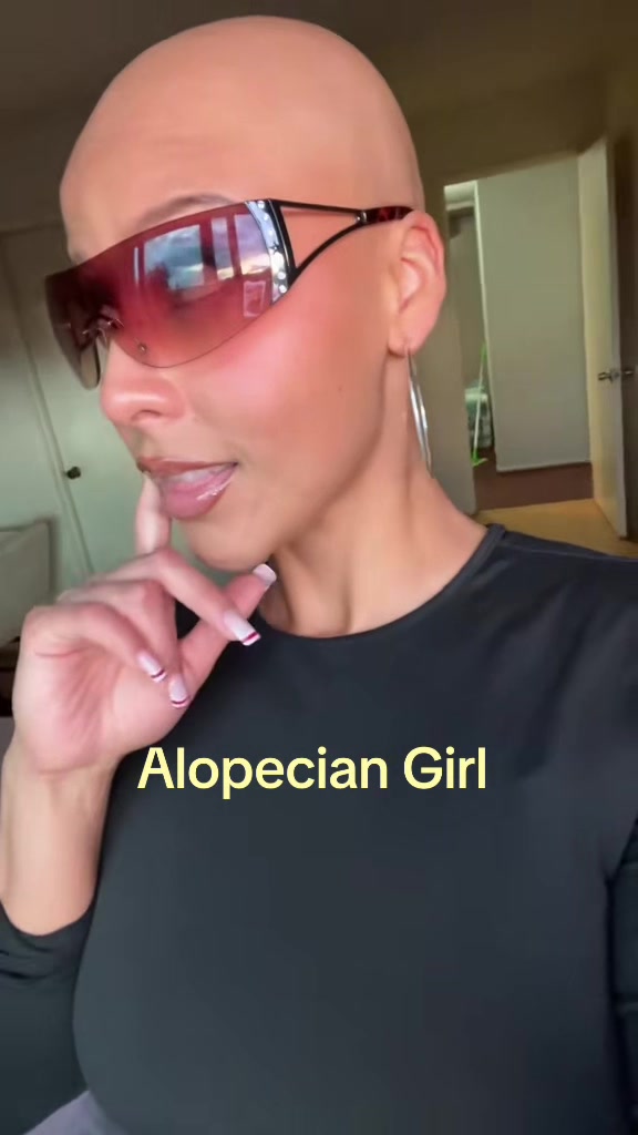 @AlopecianPrincess