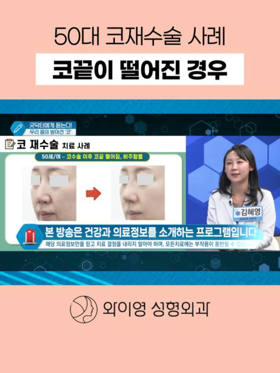 @와이영
