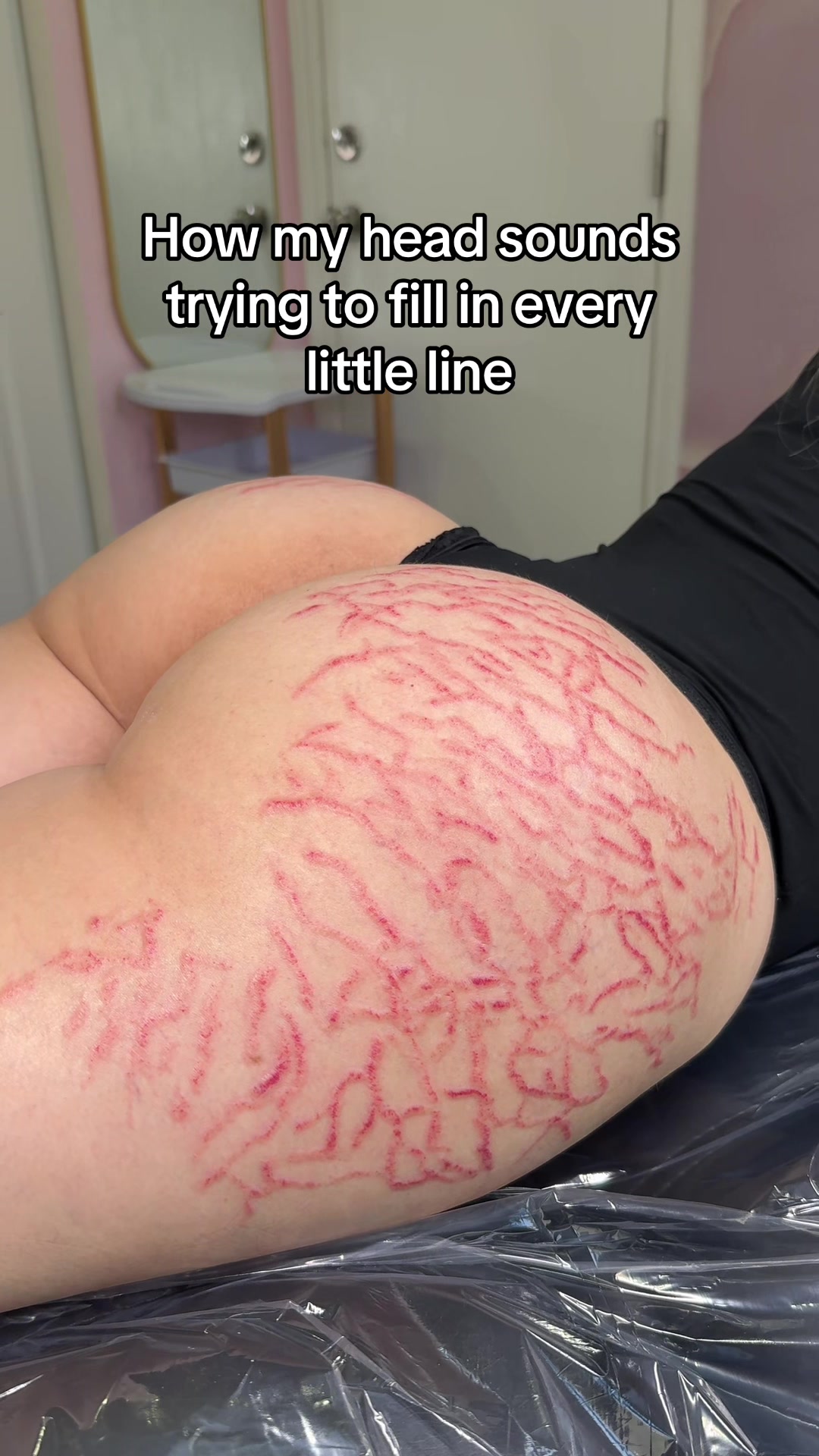 @Stretch Mark Fairy 🧚✨