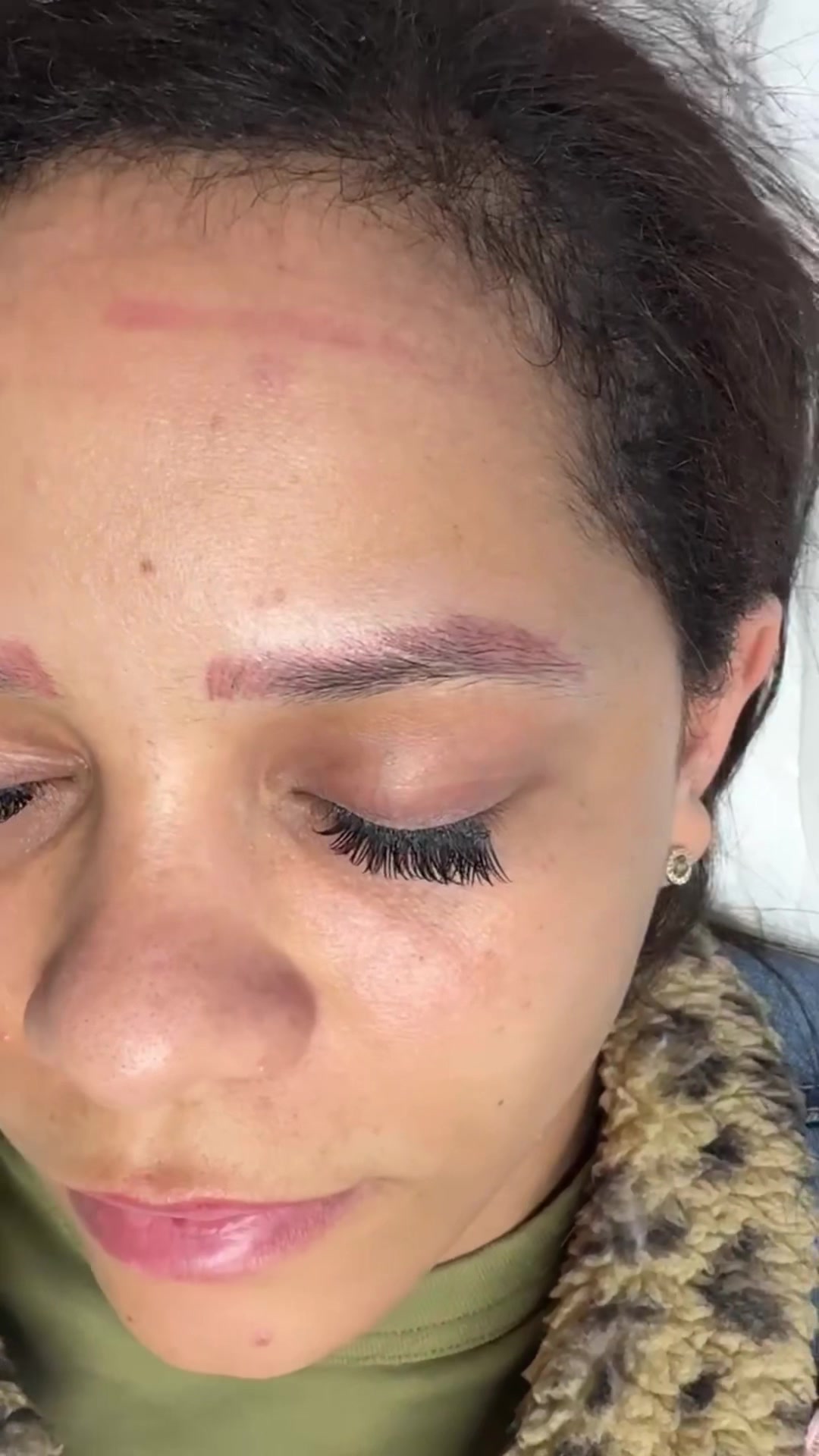 @Safe Eyebrows Tattoo Removal🗽