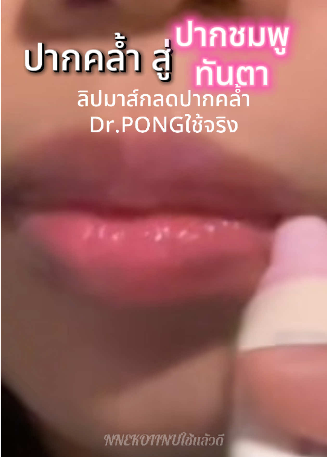@NNEkOIINUใช้แล้วดี