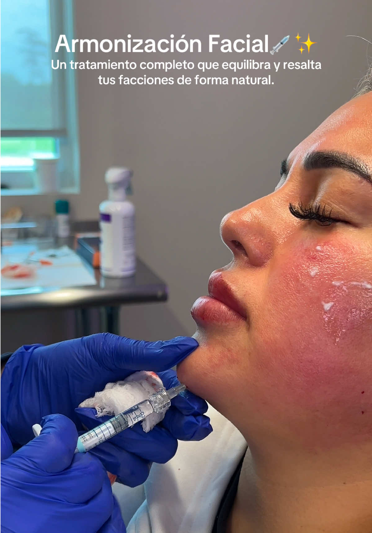 @Vanessa Injects