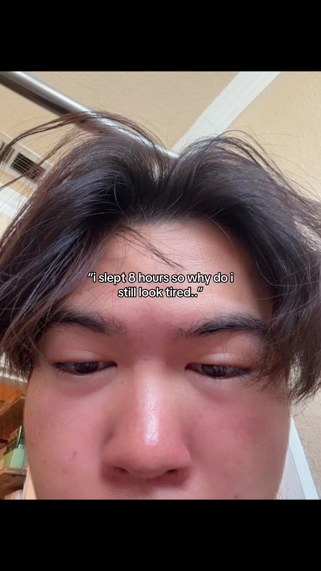 @detected