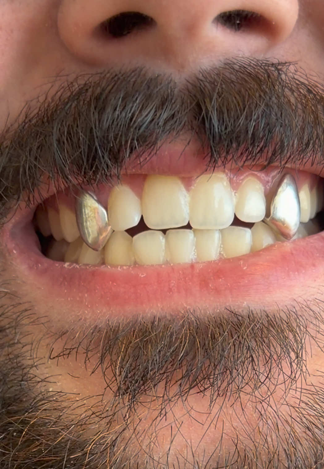 @AZ Grillz Plug