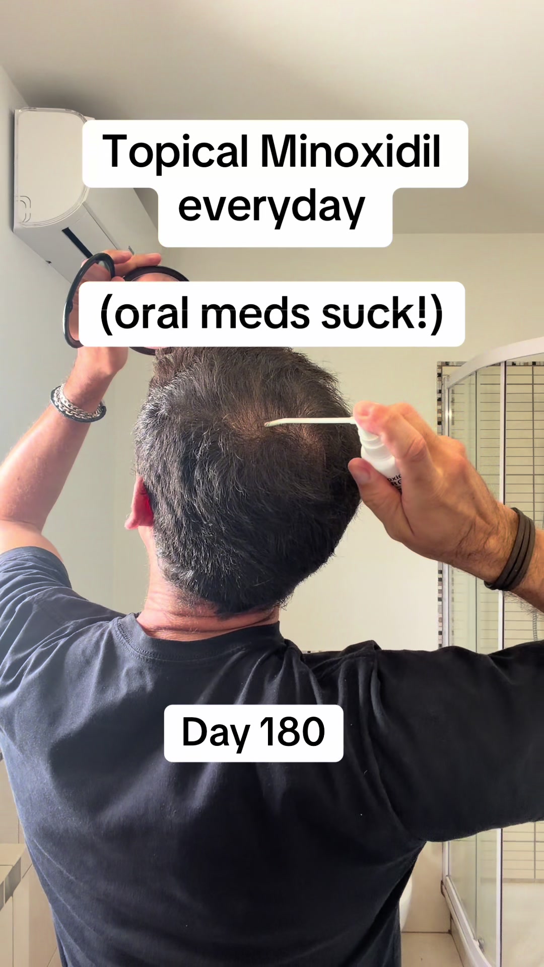 @scalp.hero
