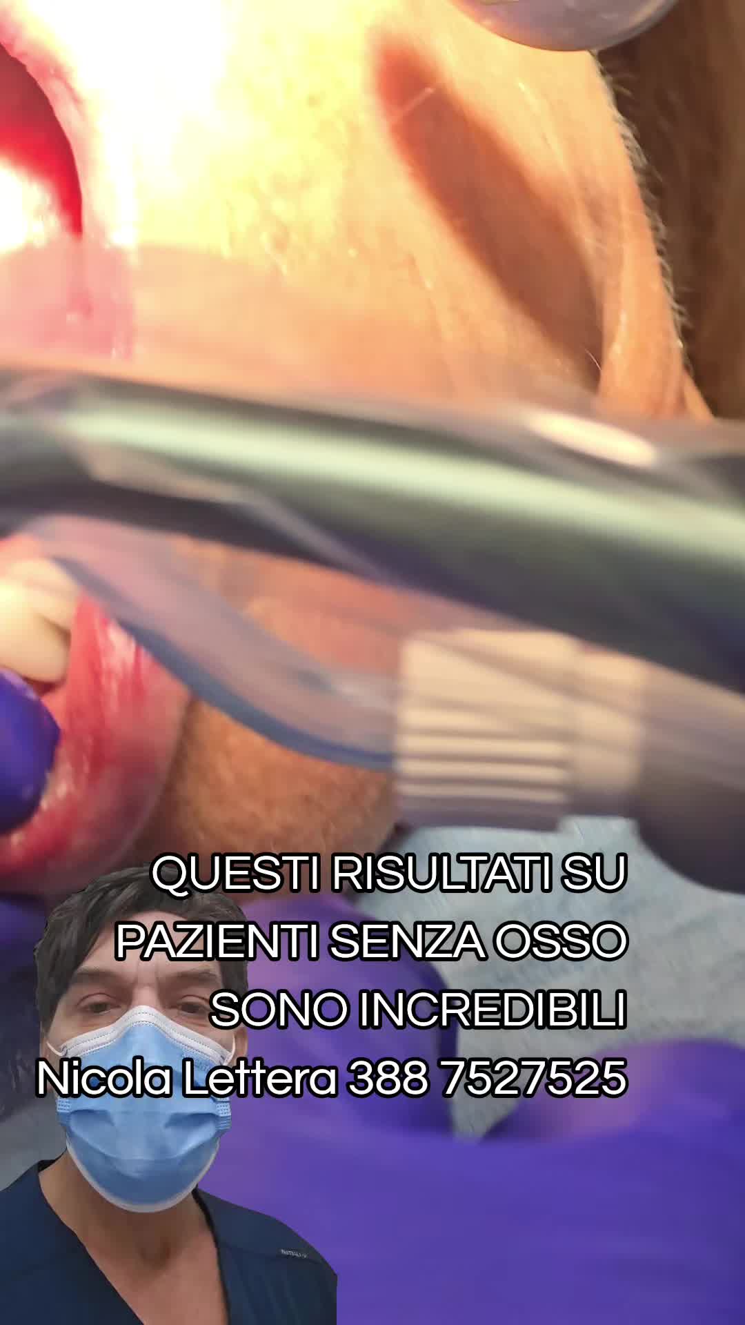 @Implantologiaprezzi