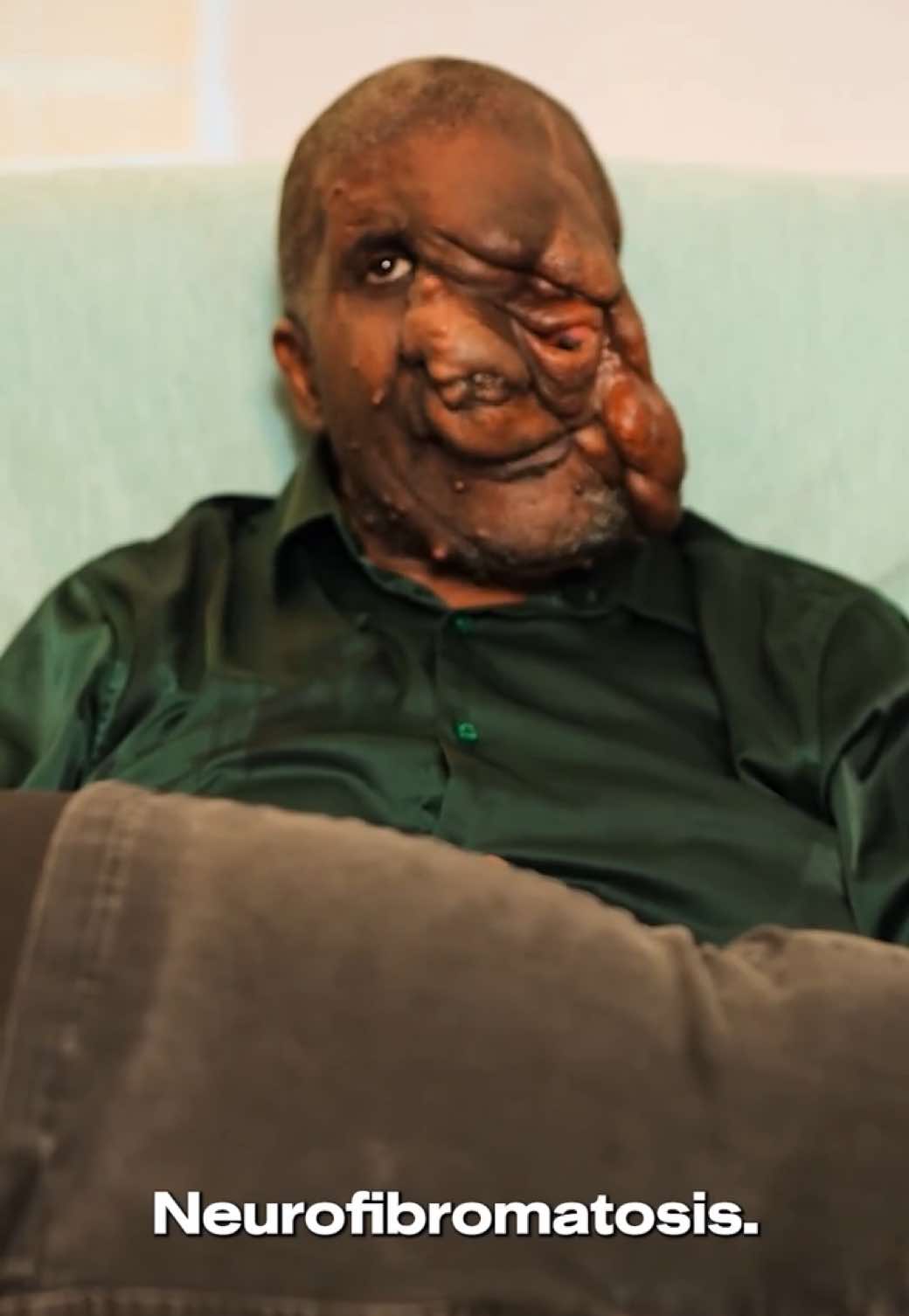 @tlc