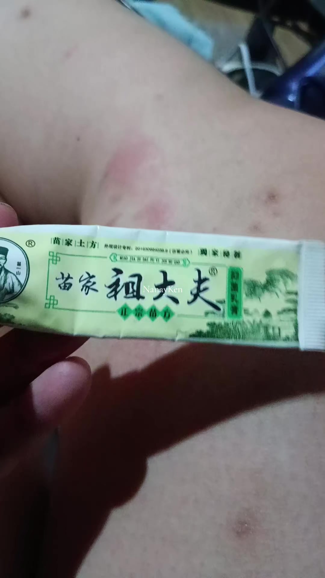 @NanayKen